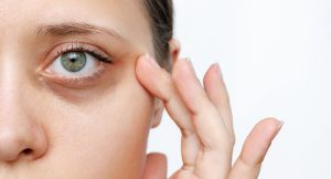 Dark Circle/Under-Eye  Bag Post Treatment Serum